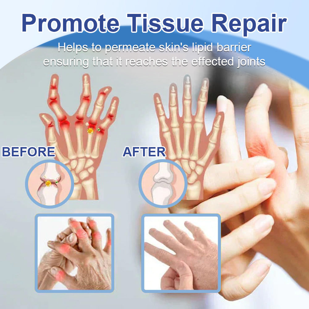 ✨Health Canada Approved: Ourlyard® Magnesium Pain Healing Bone Cream  (Treatment for arthritis, neuropathyy, rheumatic diseases, muscle spasms, twitches and sports injuries)