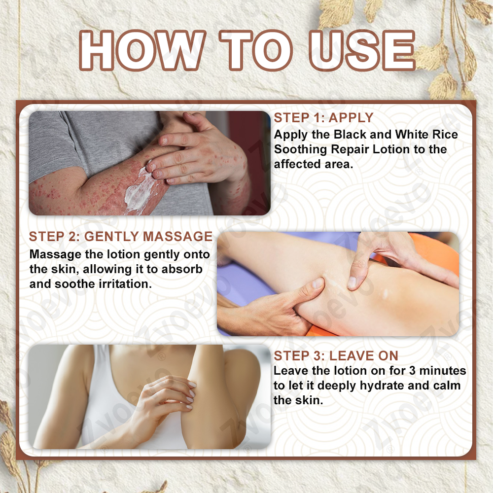 50% Discount Zvoevo® Black Rice Skin Repair Essence Cream 👨‍⚕️ MHRA Certified (Eliminates warts and skin tags, relieves psoriasis, improves keratin build-up and follicular keratinization, fades pigmentation, sun spots & age spots)