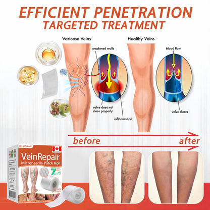🍁 Official CA Store 🇨🇦 | Celsiora® Vein Ease Microneedle Care Patch(For Spider Veins, Varicose Veins, Swelling & Leg Fatigue) - Last Day Promotion 50% OFF