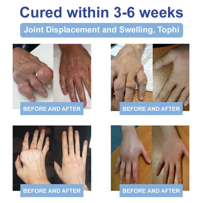 ✨Health Canada Approved: Ourlyard® Magnesium Pain Healing Bone Cream  (Treatment for arthritis, neuropathyy, rheumatic diseases, muscle spasms, twitches and sports injuries)