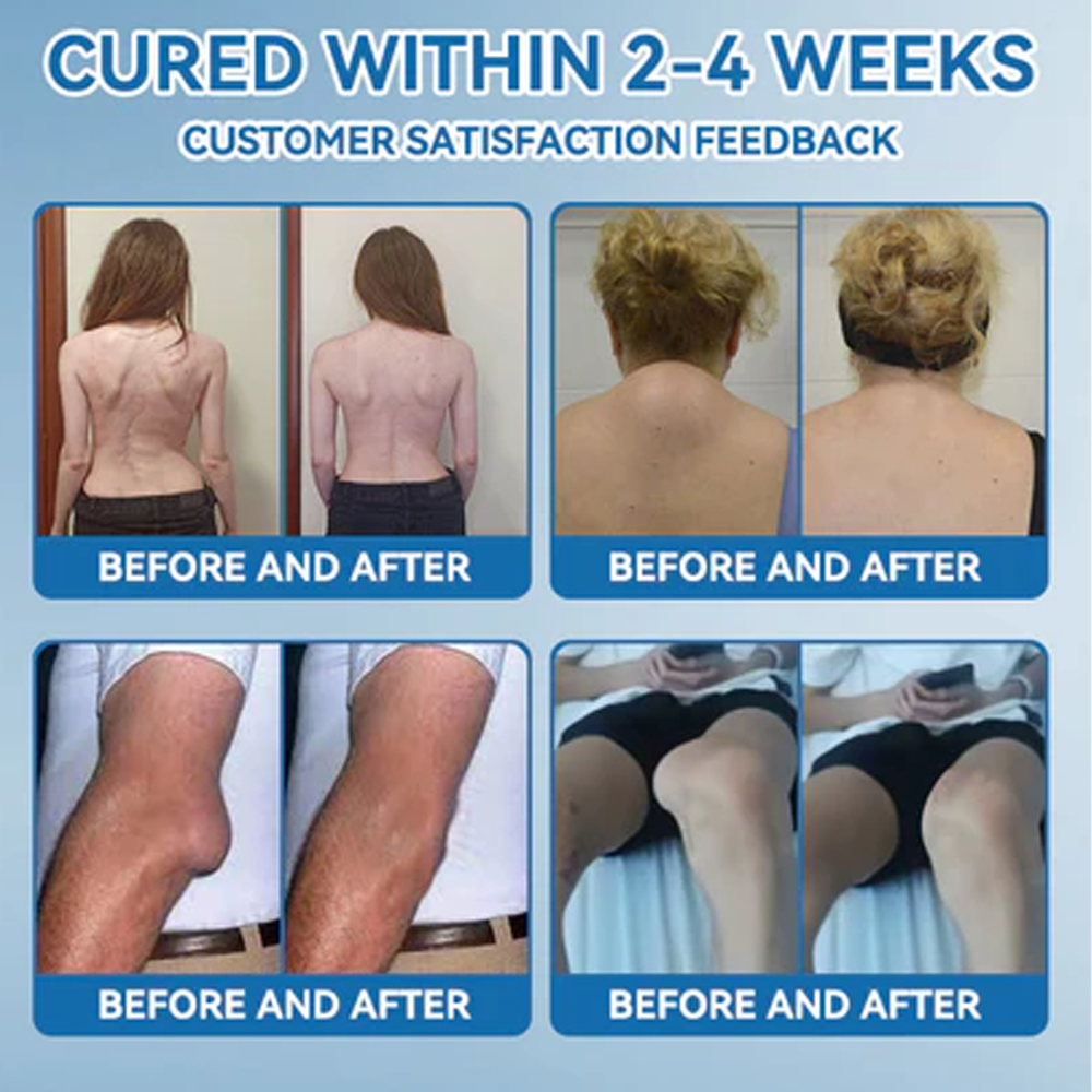 ✅ Zvoe𝐯𝗼® 𝗕𝖯𝖢-𝟏𝟓𝟕 Joint Healing Cream (🏅Gentle, Effective Relief for Arthritis & Stiff Joints | Health Canada Approved)