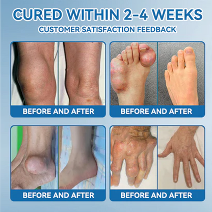 ✅ Zvoe𝐯𝗼® 𝗕𝖯𝖢-𝟏𝟓𝟕 Joint Healing Cream (🏅Gentle, Effective Relief for Arthritis & Stiff Joints | Health Canada Approved)