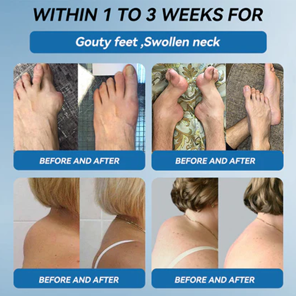 ✅ Zvoe𝐯𝗼® 𝗕𝖯𝖢-𝟏𝟓𝟕 Joint Healing Cream (🏅Gentle, Effective Relief for Arthritis & Stiff Joints | Health Canada Approved)