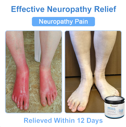 ✨Health Canada Approved: Ourlyard® Magnesium Pain Healing Bone Cream  (Treatment for arthritis, neuropathyy, rheumatic diseases, muscle spasms, twitches and sports injuries)