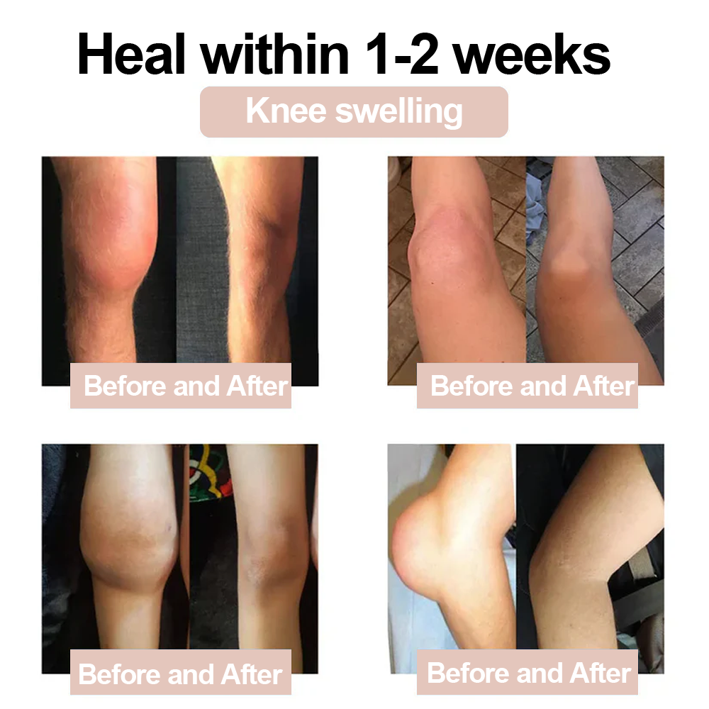 ✅ Zvoevo® Magnesium Glycinate Joint Repair Cream (Effective relief for arthritis, nerve pain, muscle spasms, rheumatic conditions, and sports injuries)