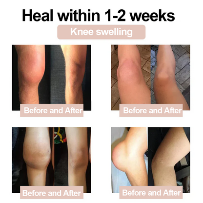 ✅ Zvoevo® Magnesium Glycinate Joint Repair Cream (Effective relief for arthritis, nerve pain, muscle spasms, rheumatic conditions, and sports injuries)