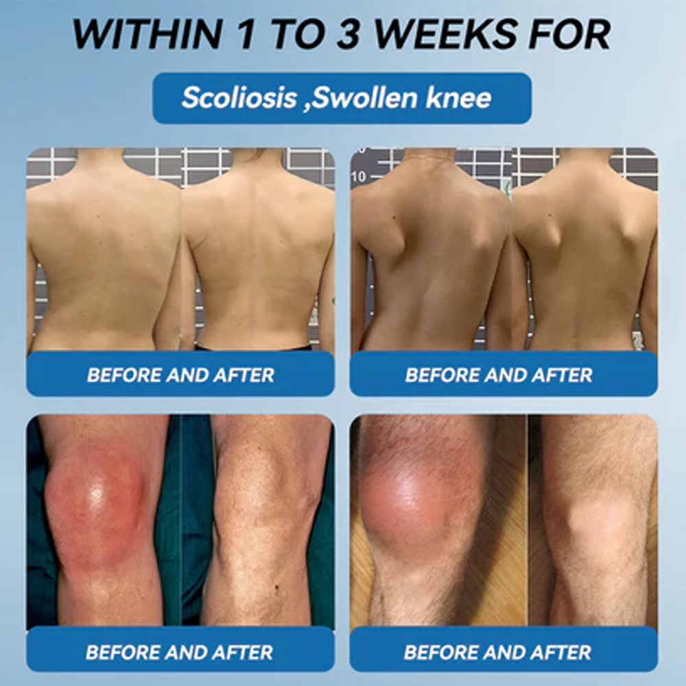 ✅ Zvoe𝐯𝗼® 𝗕𝖯𝖢-𝟏𝟓𝟕 Joint Healing Cream (🏅Gentle, Effective Relief for Arthritis & Stiff Joints | Health Canada Approved)