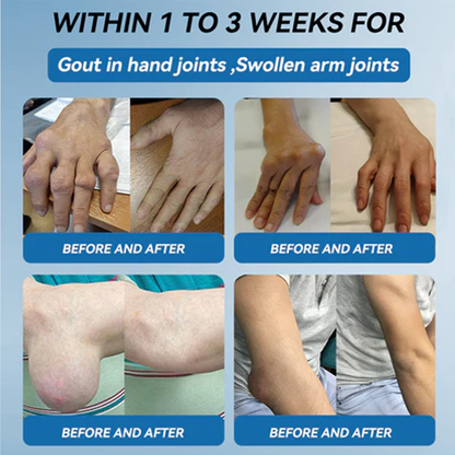 ✅ Zvoe𝐯𝗼® 𝗕𝖯𝖢-𝟏𝟓𝟕 Joint Healing Cream (🏅Gentle, Effective Relief for Arthritis & Stiff Joints | Health Canada Approved)