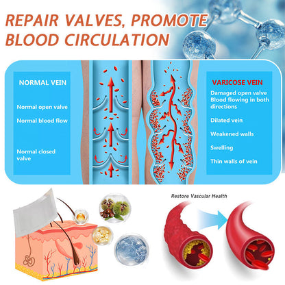 🍁 Official CA Store 🇨🇦 | Celsiora® Vein Ease Microneedle Care Patch(For Spider Veins, Varicose Veins, Swelling & Leg Fatigue) - Last Day Promotion 50% OFF