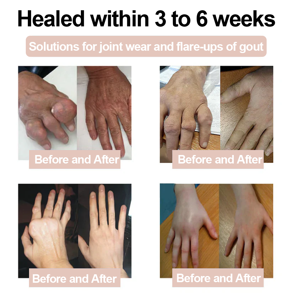 ✅ Zvoevo® Magnesium Glycinate Joint Repair Cream (Effective relief for arthritis, nerve pain, muscle spasms, rheumatic conditions, and sports injuries)