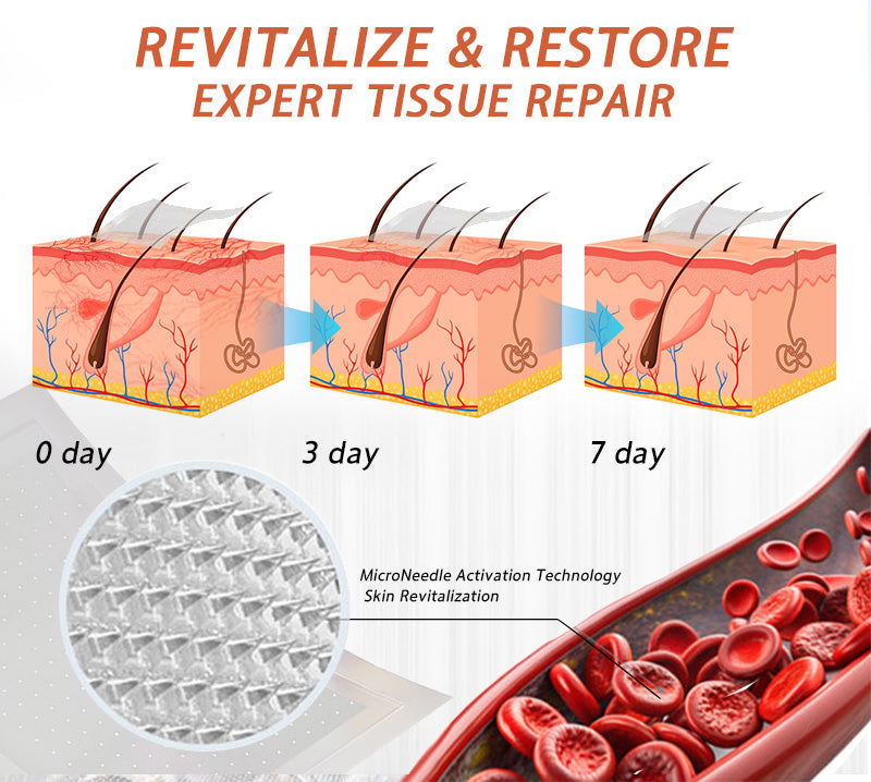 🍁 Official CA Store 🇨🇦 | Celsiora® Vein Ease Microneedle Care Patch(For Spider Veins, Varicose Veins, Swelling & Leg Fatigue) - Last Day Promotion 50% OFF