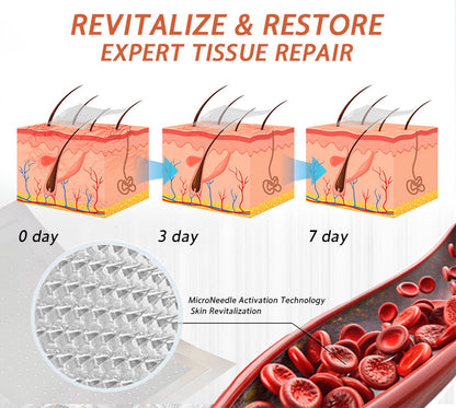 🍁 Official CA Store 🇨🇦 | Celsiora® Vein Ease Microneedle Care Patch(For Spider Veins, Varicose Veins, Swelling & Leg Fatigue) - Last Day Promotion 50% OFF