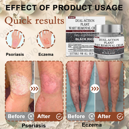 50% Discount Zvoevo® Black Rice Skin Repair Essence Cream 👨‍⚕️ MHRA Certified (Eliminates warts and skin tags, relieves psoriasis, improves keratin build-up and follicular keratinization, fades pigmentation, sun spots & age spots)