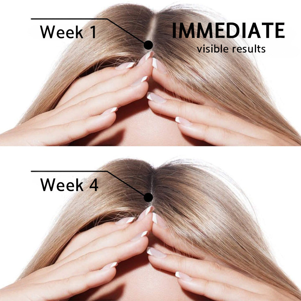 ☘️💟 Official CA Store 🇨🇦 | 🔥Rolimey® Highly Effective Biotin & Rosemary Hair Growth Serum — (🔥 Limited-Time Offer, ⏳ Last Day Promotion 50% OFF)