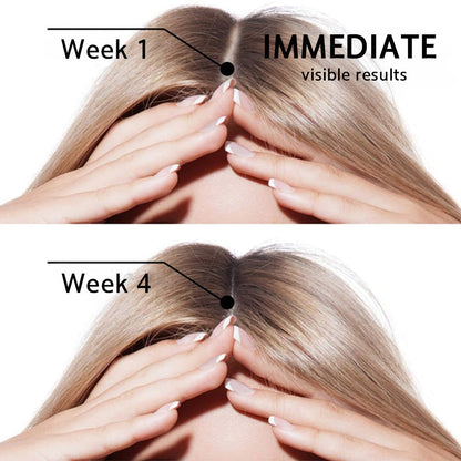 ☘️💟 Official CA Store 🇨🇦 | 🔥Rolimey® Highly Effective Biotin & Rosemary Hair Growth Serum — (🔥 Limited-Time Offer, ⏳ Last Day Promotion 50% OFF)